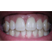Teeth